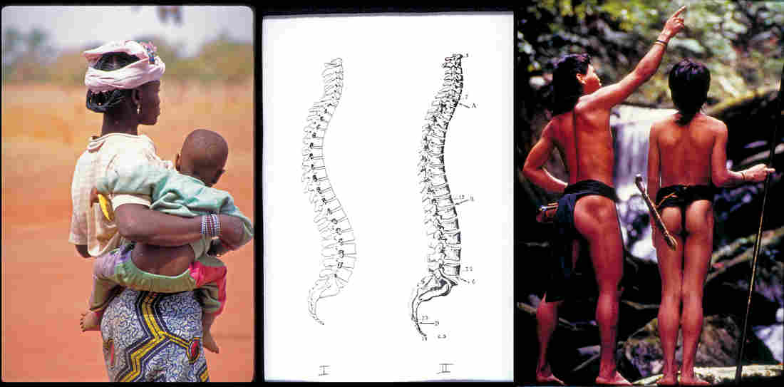 Lost Posture: Why Some Indigenous Cultures May Not Have Back Pain : Goats and Soda : NPR