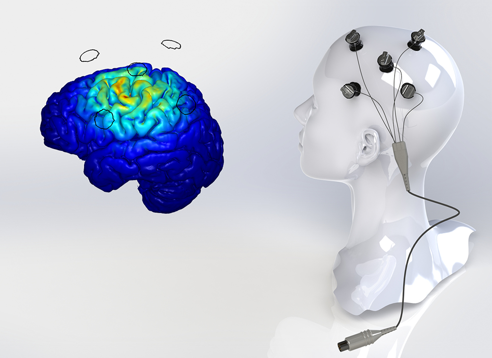 The Unfinished Science Behind the New Wave of Electrical Brain Stimulation | Science | WIRED
