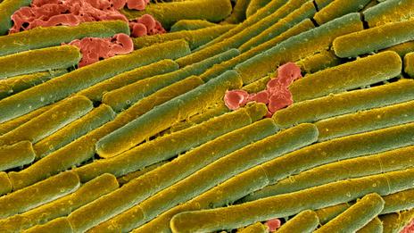BBC – Future – How faecal transplantation is gaining credibility